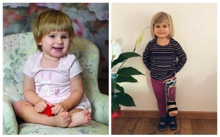 Weronika wkrótce wyleci do USA, nadal brakuje pieniędzy na rehabilitację